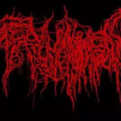 Trichomoniasis
