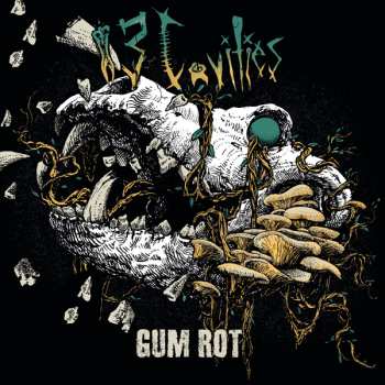 MC 13 Cavities: Gum Rot