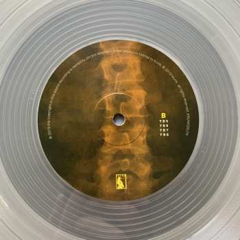 3LP Frakkur: 2000 - 2004 LTD | CLR