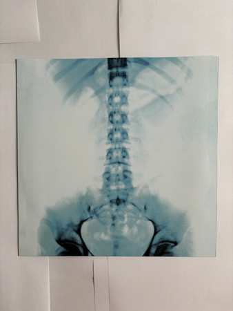 LP Achille Lauro: Ragazzi Madre CLR