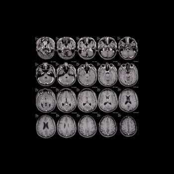 2LP Bertrand Burgalat: Portrait-Robot