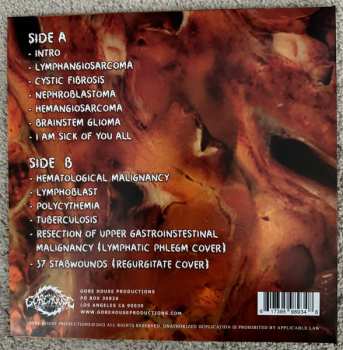 LP Blasted Pancreas: Carcinoma CLR | LTD