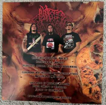 LP Blasted Pancreas: Carcinoma CLR | LTD