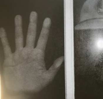 2LP Blockhead: The Aux