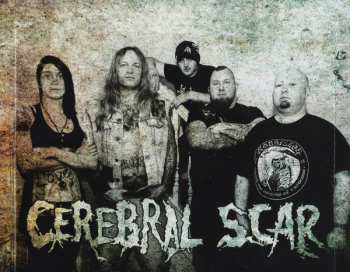 CD Cerebral Scar: No Remorse Required