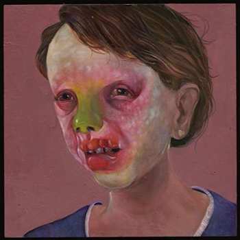 Album Controlled Bleeding: Larva Lumps And Baby Bumps