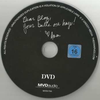 CD/DVD Dwarves: Are Born Again DLX