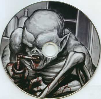 CD Intestinal Rot: Consuming Fermented Bile