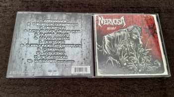 CD Nervosa: Agony