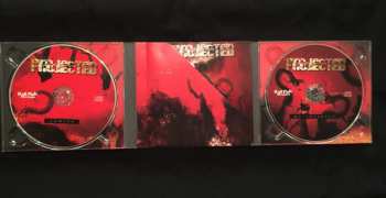 2CD Projected: Ignite My Insanity