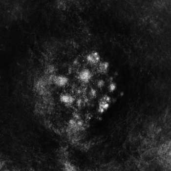CD Saffronkeira: Synecdoche