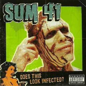 LP Sum 41: Does This Look Infected? LTD