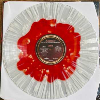 LP Tom Howe: Knuckles