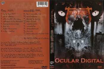DVD Tourniquet: Ocular Digital