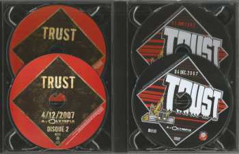 2CD/2DVD Trust: À L'Olympia (4/12/2007) ‎/ Rockpalast (5 Juin 1982)