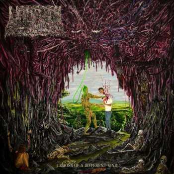 CD Undeath: Lesions Of A Different Kind