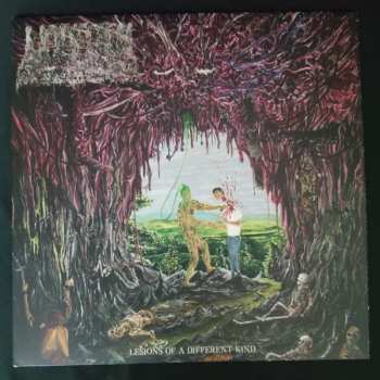 LP Undeath: Lesions Of A Different Kind CLR | LTD