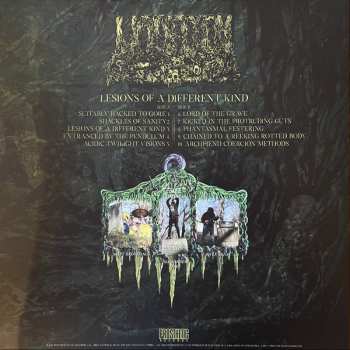 LP Undeath: Lesions Of A Different Kind LTD | CLR